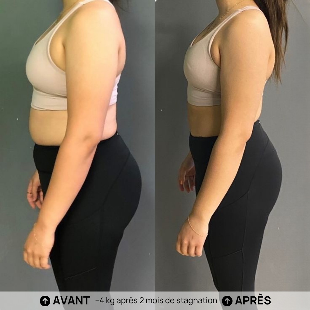 Avant Après
