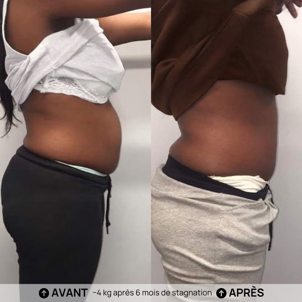Avant Après